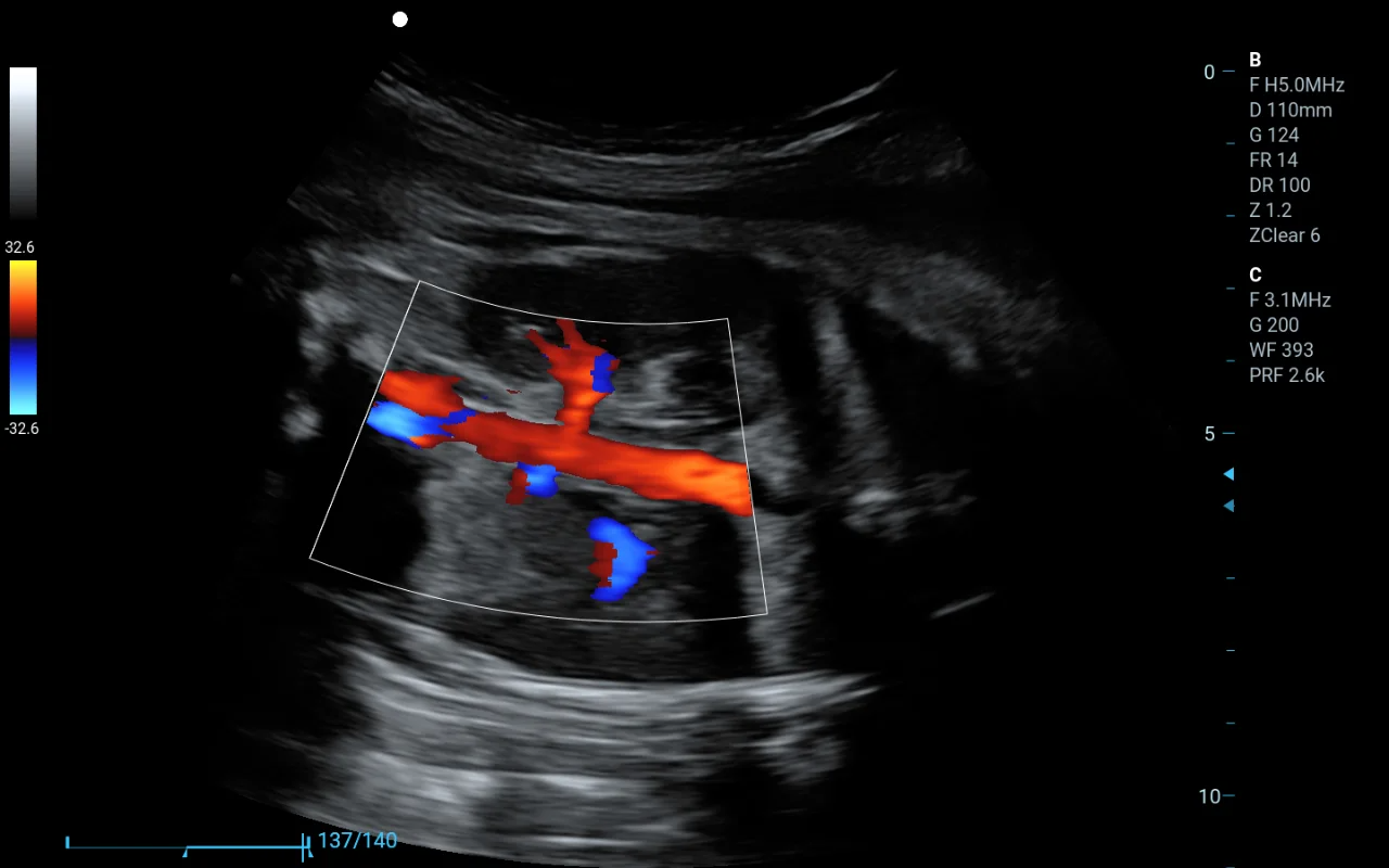 三維掃描成片.png 三維掃描成片.png